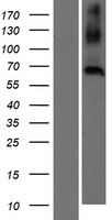 C20orf152 (CNBD2) Human Over-expression Lysates NM_080834