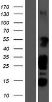 STK35 Human Over-expression Lysates NM_080836