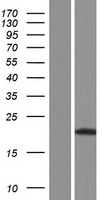DUSP19 Human Over-expression Lysates NM_001142314