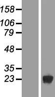 DUSP19 Human Over-expression Lysates NM_080876