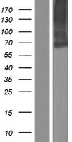 SLC34A3 Human Over-expression Lysates NM_001177316