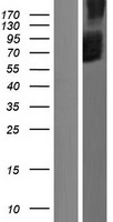 SLC34A3 Human Over-expression Lysates NM_080877