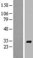 ls142684 rab40a human over expression lysates nm 080879 wb testing 1