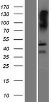 SAMD8 Human Over-expression Lysates NM_001174156