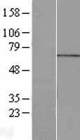 MPP7 Human Over-expression Lysates NM_173496