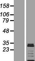 VTI1A Human Over-expression Lysates NM_145206