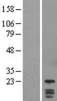 DYDC1 Human Over-expression Lysates NM_138812