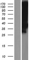 LDLRAD3 Human Over-expression Lysates NM_174902