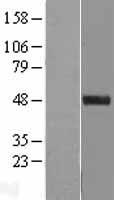 SPINDOC Human Over-expression Lysates NM_138471
