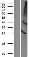ls144110 tmem86a human over expression lysates nm 153347 wb testing 1