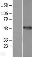 ls144193 amdhd1 human over expression lysates nm 152435 wb testing 1
