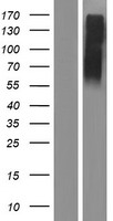 SLC2A14 Human Over-expression Lysates NM_153449