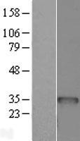 BCDIN3D Human Over-expression Lysates NM_181708