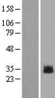 GLIPR1L2 Human Over-expression Lysates NM_152436