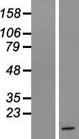 LYRM5 (ETFRF1) Human Over-expression Lysates NM_001001660