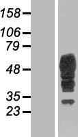 Bestrophin 3 (BEST3) Human Over-expression Lysates NM_152439