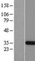 C12orf60 Human Over-expression Lysates NM_175874