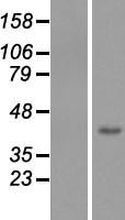 FBXL14 Human Over-expression Lysates NM_152441