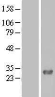 PHETA1 Human Over-expression Lysates NM_144671