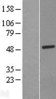 ls144811 c13orf31 lacc1 human over expression lysates nm 001128303 wb testing 1