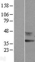 RDH12 Human Over-expression Lysates NM_152443