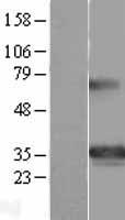 GSC Human Over-expression Lysates NM_173849