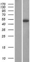 SERPINA12 Human Over-expression Lysates NM_173850