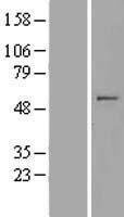 MIPOL 1 (MIPOL1) Human Over-expression Lysates NM_138731