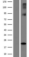 SLC38A6 Human Over-expression Lysates NM_001172702