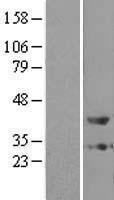 ZADH1 (PTGR2) Human Over-expression Lysates NM_152444