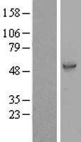 C14orf166B (LRRC74A) Human Over-expression Lysates NM_001081002