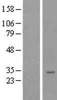 ls145748 lysmd4 human over expression lysates nm 152449 wb testing 1