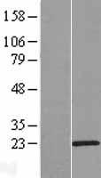 C15orf32 Human Over-expression Lysates NM_153040