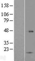 ls145942 tmco5a human over expression lysates nm 152453 wb testing 1