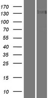 Tau tubulin kinase 2 (TTBK2) Human Over-expression Lysates NM_173500