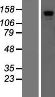 CDAN1 Human Over-expression Lysates NM_138477