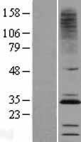 CMTM2 Human Over-expression Lysates NM_144673