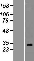 RNF151 Human Over-expression Lysates NM_174903