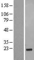 GSG1L Human Over-expression Lysates NM_144675