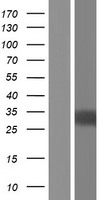 Interleukin 34 (IL34) Human Over-expression Lysates NM_001172771