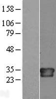 Interleukin 34 (IL34) Human Over-expression Lysates NM_152456