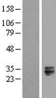 ls146456 tmed6 human over expression lysates nm 144676 wb testing 1