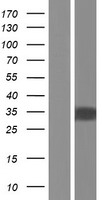 ls146542 znf688 human over expression lysates nm 001024683 wb testing 2