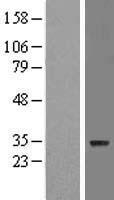 ls146542 znf688 human over expression lysates nm 145271 wb testing 1