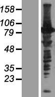 C16orf71 Human Over-expression Lysates NM_139170