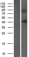 B3GNTL1 Human Over-expression Lysates NM_001009905