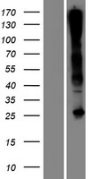 C17orf77 Human Over-expression Lysates NM_152460