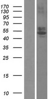 RTN4RL1 Human Over-expression Lysates NM_178568