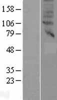 ls146802 slc47a2 human over expression lysates nm 152908 wb testing 1