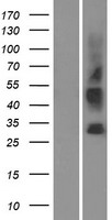 ls146861 slc35g3 human over expression lysates nm 152462 wb testing 1